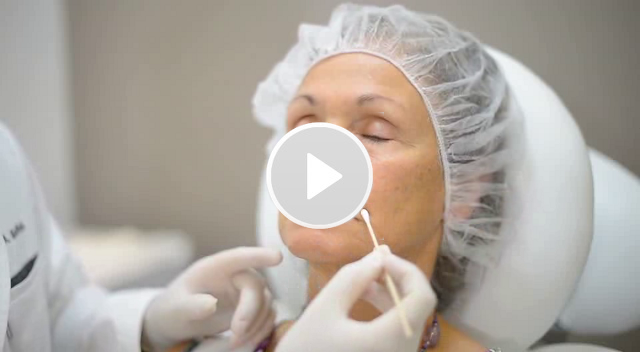Bioplastía - Relleno de arrugas - Explicación del tratamiento - Clínica Dr. Badiola